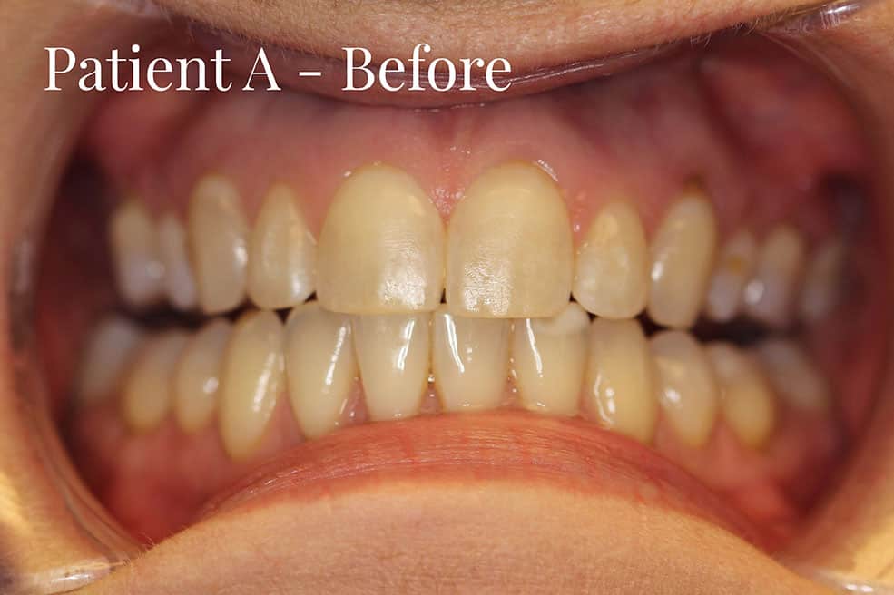 Kor Whitening Cranberry Dental Studio