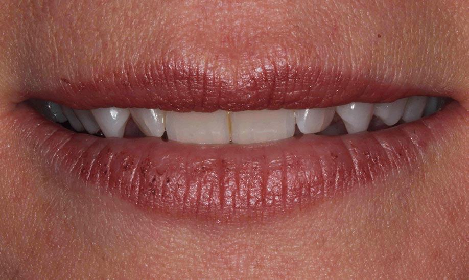 before cranberry dental studio