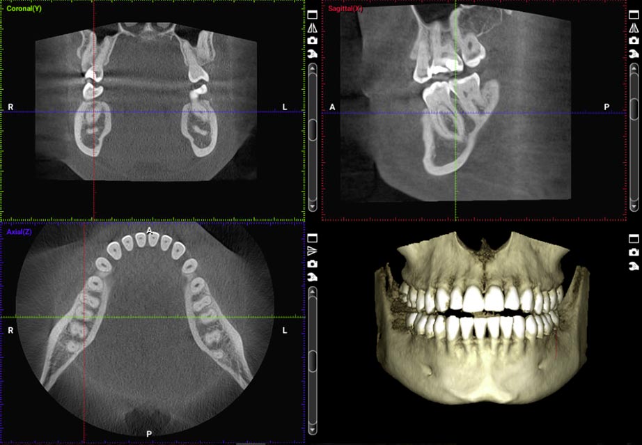 Cranberry Dental Studio | CBCT scan